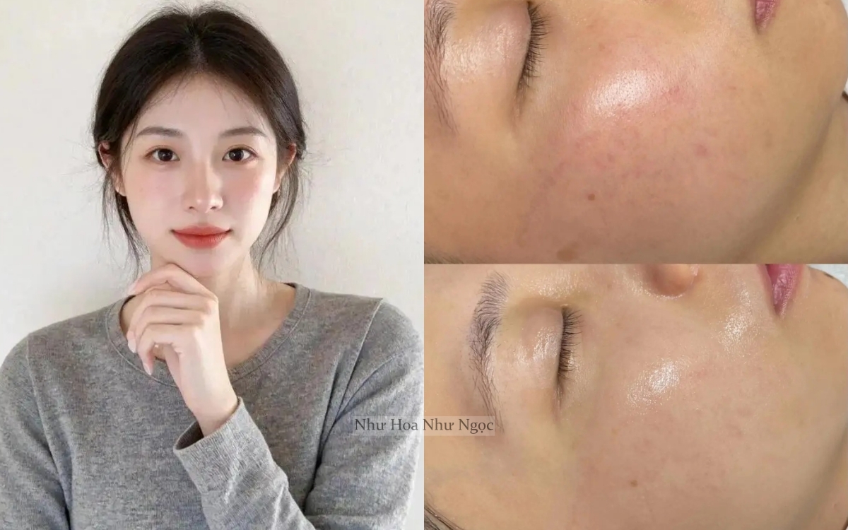 Tôi đã tìm ra cách "bơm" collagen cho da căng mướt, tới độ không ai ngờ tôi đã 35 tuổi- Ảnh 1. Tôi đã tìm ra cách "bơm" collagen cho da căng mướt, tới độ không ai ngờ tôi đã 35 tuổi- Ảnh 1.