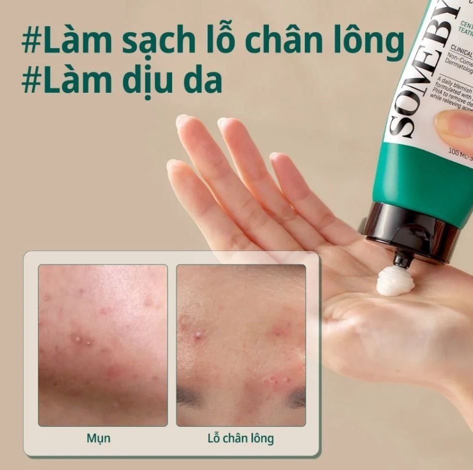 6 sữa rửa mặt được đánh giá cao vì khả năng làm sạch sâu mà không làm khô da- Ảnh 4. 6 sữa rửa mặt được đánh giá cao vì khả năng làm sạch sâu mà không làm khô da- Ảnh 4.