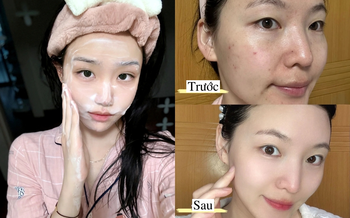 6 sữa rửa mặt được đánh giá cao vì khả năng làm sạch sâu mà không làm khô da- Ảnh 1. 6 sữa rửa mặt được đánh giá cao vì khả năng làm sạch sâu mà không làm khô da- Ảnh 1.