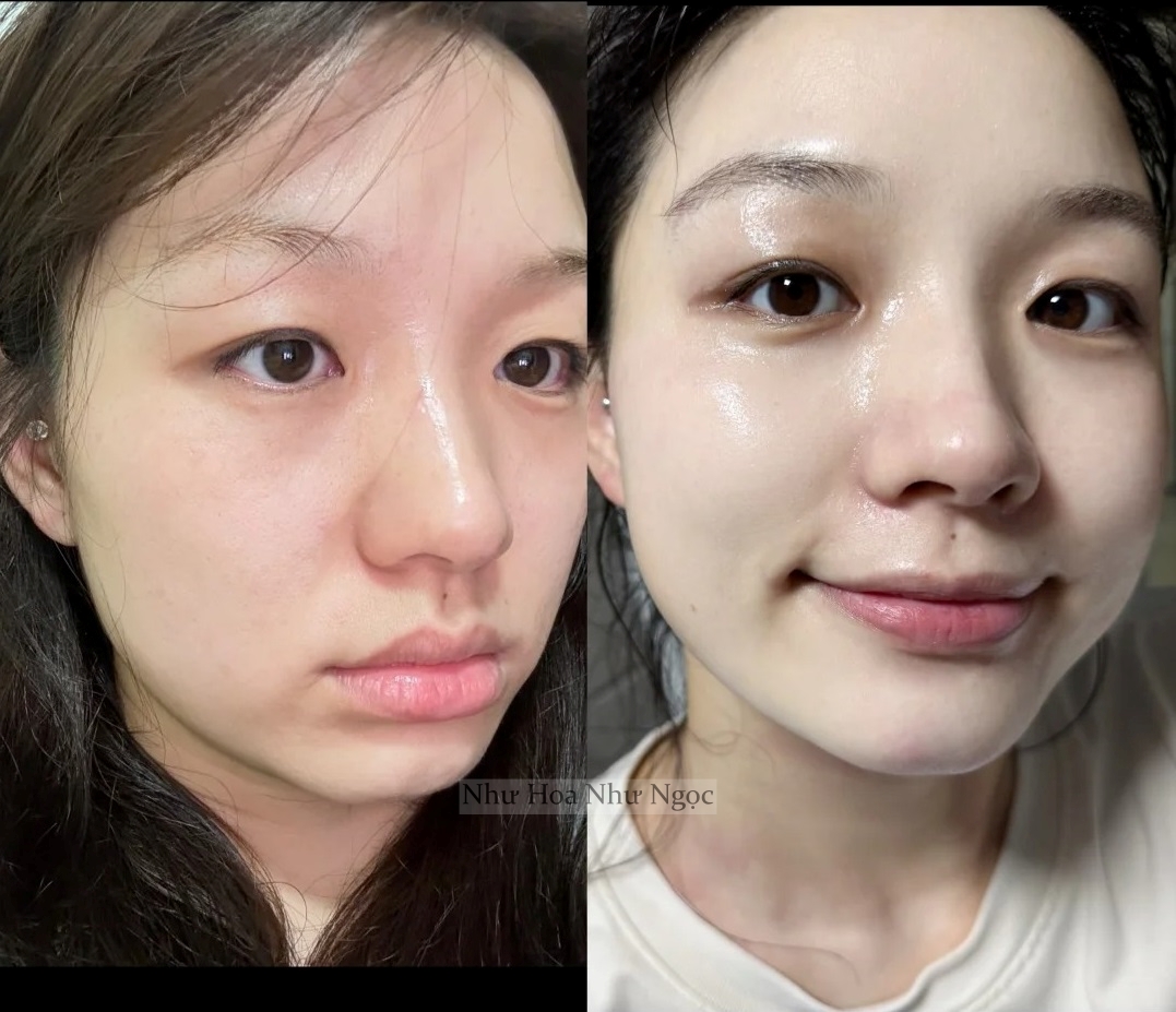 Người phụ nữ ngoài 30 tuổi giữ da bóng như gương nhờ 5 lọ "serum bơm nước" đỉnh cao- Ảnh 2. Người phụ nữ ngoài 30 tuổi giữ da bóng như gương nhờ 5 lọ "serum bơm nước" đỉnh cao- Ảnh 2.