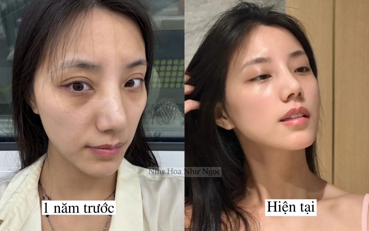 Tôi lấy lại làn da tuổi 20 nhờ 1 năm ngủ sớm, ăn lành và chăm da đúng cách- Ảnh 1. Tôi lấy lại làn da tuổi 20 nhờ 1 năm ngủ sớm, ăn lành và chăm da đúng cách- Ảnh 1.