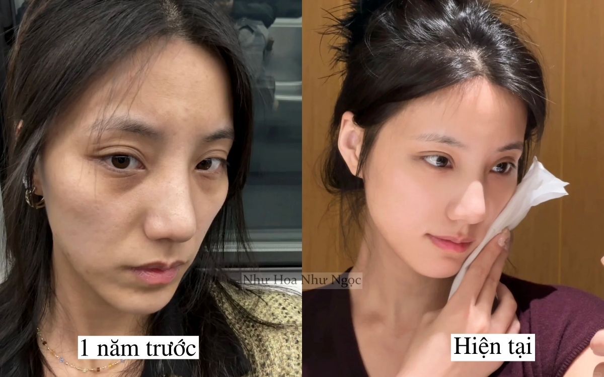 Tôi lấy lại làn da tuổi 20 nhờ 1 năm ngủ sớm, ăn lành và chăm da đúng cách- Ảnh 3. Tôi lấy lại làn da tuổi 20 nhờ 1 năm ngủ sớm, ăn lành và chăm da đúng cách- Ảnh 3.