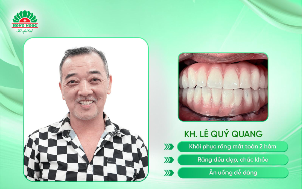 U70 hạnh phúc khi tìm lại niềm vui trọn vẹn trong từng bữa cơm nhà sau trồng răng Implant- Ảnh 3. U70 hạnh phúc khi tìm lại niềm vui trọn vẹn trong từng bữa cơm nhà sau trồng răng Implant- Ảnh 3.