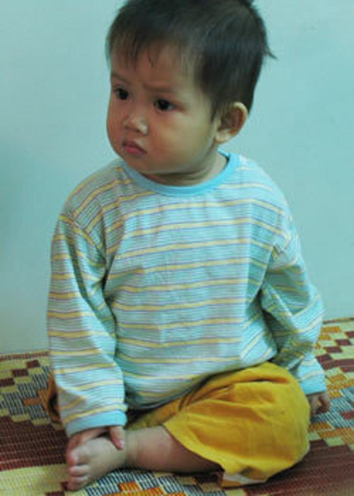 "Chú lính chì" Thiện Nhân: Từ nỗi đau thể xác của cậu bé 1 tuần tuổi bị bỏ rơi, đến chàng sinh viên 19 tuổi với suất học bổng 85%- Ảnh 2.