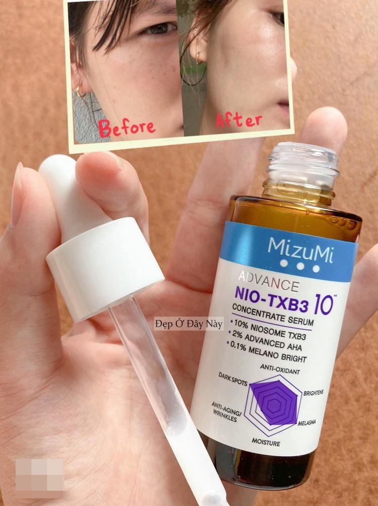 BTV chọn ra 5 sản phẩm làm trắng da, ngừa nám toàn diện ai dùng cũng mê- Ảnh 2. BTV chọn ra 5 sản phẩm làm trắng da, ngừa nám toàn diện ai dùng cũng mê- Ảnh 2.