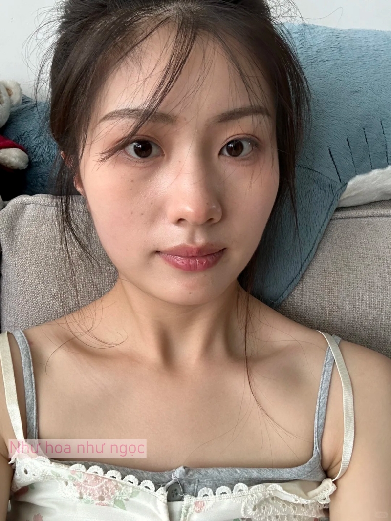 Tôi bất ngờ vì dùng serum collagen kèm cây lăn kim, ban đầu hơi sợ nhưng càng dùng lại thấy da càng đẹp- Ảnh 1. Tôi bất ngờ vì dùng serum collagen kèm cây lăn kim, ban đầu hơi sợ nhưng càng dùng lại thấy da càng đẹp- Ảnh 1.