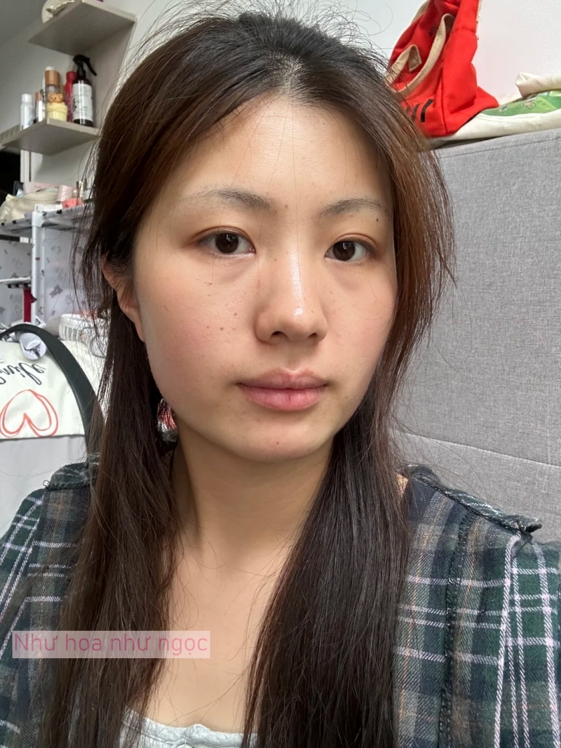 Tôi bất ngờ vì dùng serum collagen kèm cây lăn kim, ban đầu hơi sợ nhưng càng dùng lại thấy da càng đẹp- Ảnh 2. Tôi bất ngờ vì dùng serum collagen kèm cây lăn kim, ban đầu hơi sợ nhưng càng dùng lại thấy da càng đẹp- Ảnh 2.