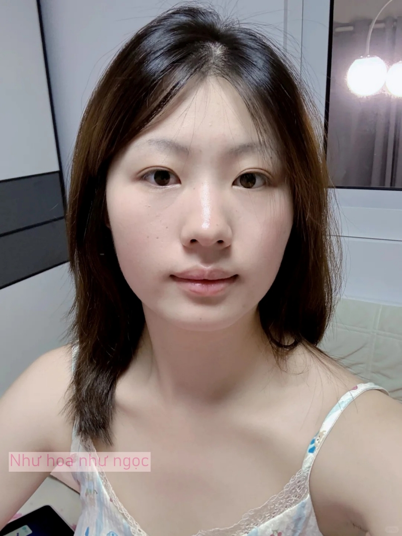 Tôi bất ngờ vì dùng serum collagen kèm cây lăn kim, ban đầu hơi sợ nhưng càng dùng lại thấy da càng đẹp- Ảnh 14. Tôi bất ngờ vì dùng serum collagen kèm cây lăn kim, ban đầu hơi sợ nhưng càng dùng lại thấy da càng đẹp- Ảnh 14.