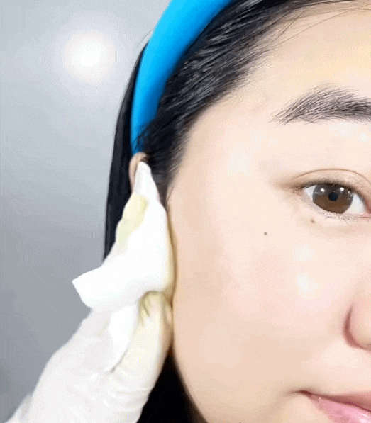 Tôi bất ngờ vì dùng serum collagen kèm cây lăn kim, ban đầu hơi sợ nhưng càng dùng lại thấy da càng đẹp- Ảnh 5. Tôi bất ngờ vì dùng serum collagen kèm cây lăn kim, ban đầu hơi sợ nhưng càng dùng lại thấy da càng đẹp- Ảnh 5.