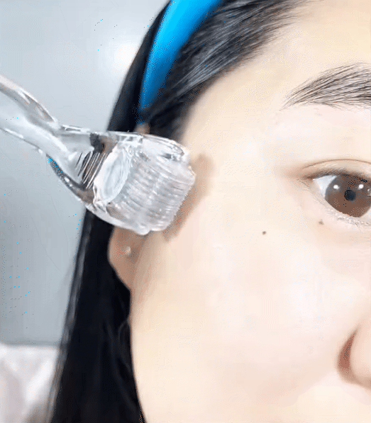 Tôi bất ngờ vì dùng serum collagen kèm cây lăn kim, ban đầu hơi sợ nhưng càng dùng lại thấy da càng đẹp- Ảnh 7. Tôi bất ngờ vì dùng serum collagen kèm cây lăn kim, ban đầu hơi sợ nhưng càng dùng lại thấy da càng đẹp- Ảnh 7.