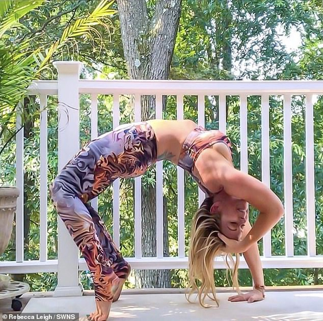 Người phụ nữ rách động mạch cổ, đột quỵ sau tư thế yoga "sống ảo"- Ảnh 3.