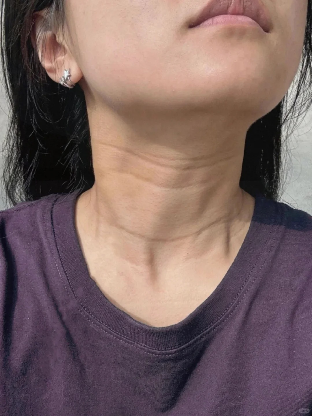 5 vùng da lão hóa nhanh nhất mà 90% chị em đều bỏ quên, nhìn vào dễ tưởng là người già- Ảnh 4. 5 vùng da lão hóa nhanh nhất mà 90% chị em đều bỏ quên, nhìn vào dễ tưởng là người già- Ảnh 4.