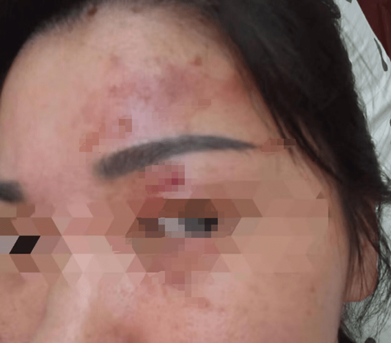 Người phụ nữ bỏng giác mạc vì làm 1 việc khi giặt đồ- Ảnh 1.