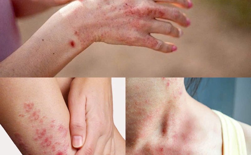 Danh mục cứu trợ vùng lũ có cả những sản phẩm vệ sinh, sát khuẩn rất thiết thực cho sức khỏe người dân vùng ngập lụt- Ảnh 2.