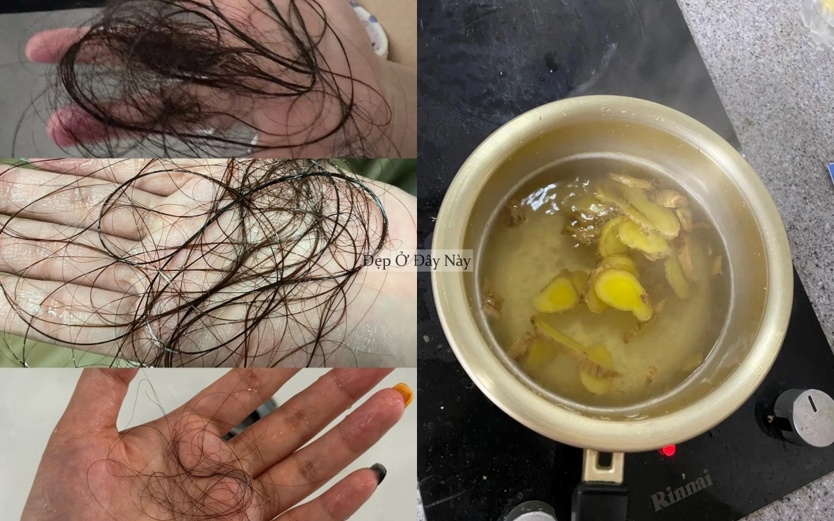 Xu hướng gội đầu với thứ củ rẻ tiền n&agrave;y để giảm rụng t&oacute;c thần kỳ- Ảnh 4.