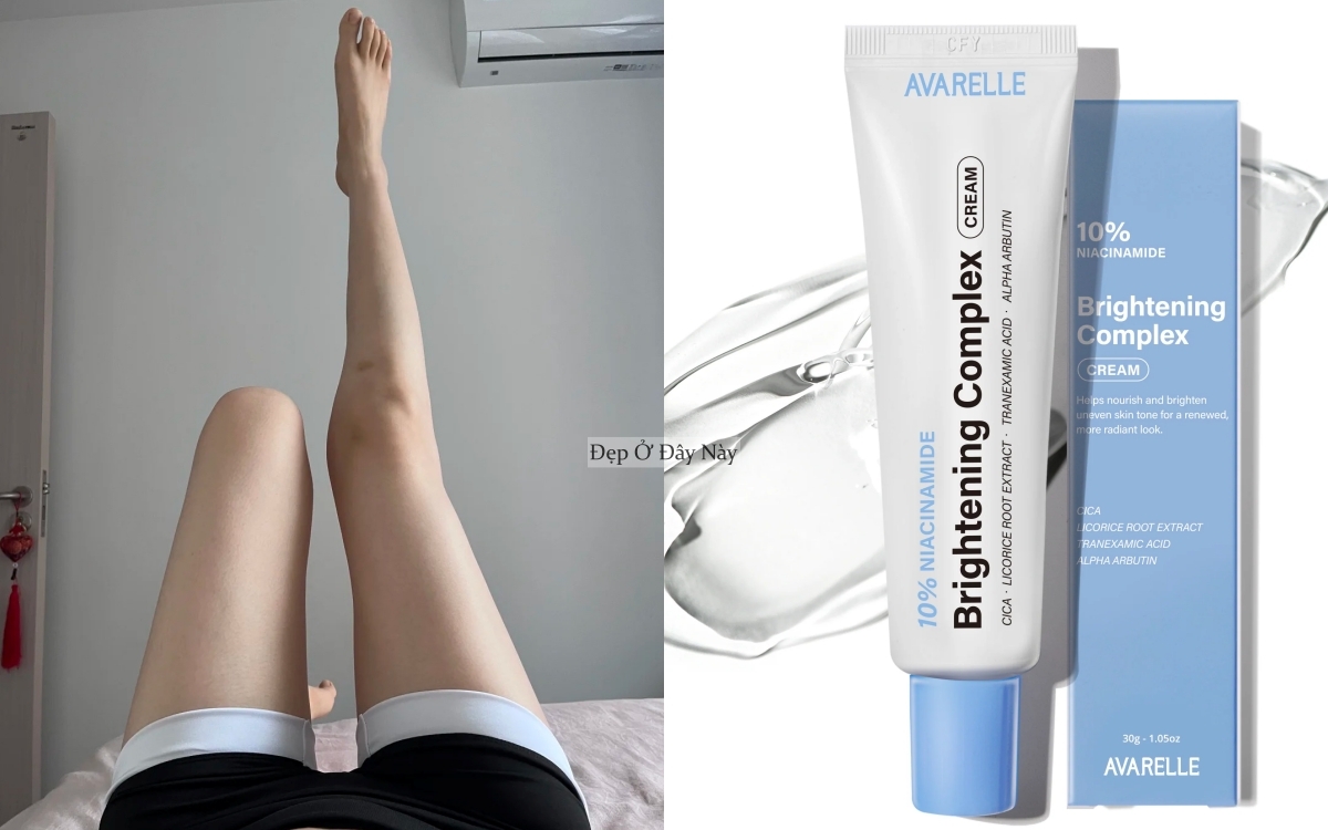 Vùng da "phú bà" mà nhiều chị em thường bỏ qua khi dưỡng da- Ảnh 5.