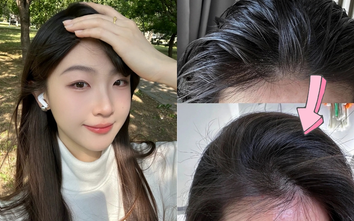 Mưa gió tóc bết, da đầu ngứa? 5 mẹo cực hay giúp tóc sạch bồng bềnh cả ngày!- Ảnh 1.