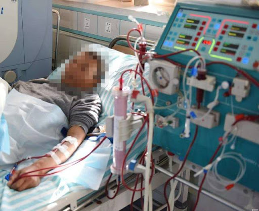 Thanh niên 20 tuổi thận teo nhỏ, mất chức năng vì bỏ qua 3 dấu hiệu cảnh báo- Ảnh 1. Thanh niên 20 tuổi thận teo nhỏ, mất chức năng vì bỏ qua 3 dấu hiệu cảnh báo- Ảnh 1.