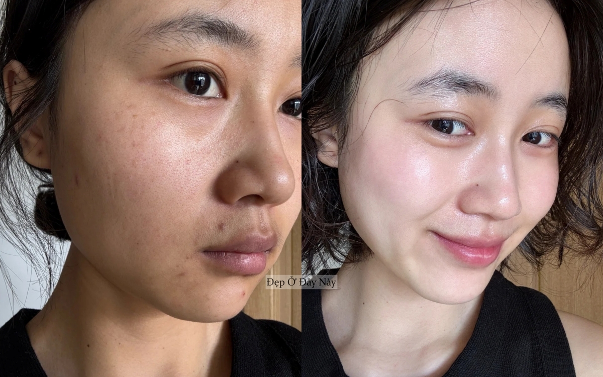 Tôi không skincare cầu kỳ, chỉ ngủ sớm và dưỡng dầu là làn da đã lột xác ngoạn mục!- Ảnh 5. Tôi không skincare cầu kỳ, chỉ ngủ sớm và dưỡng dầu là làn da đã lột xác ngoạn mục!- Ảnh 5.