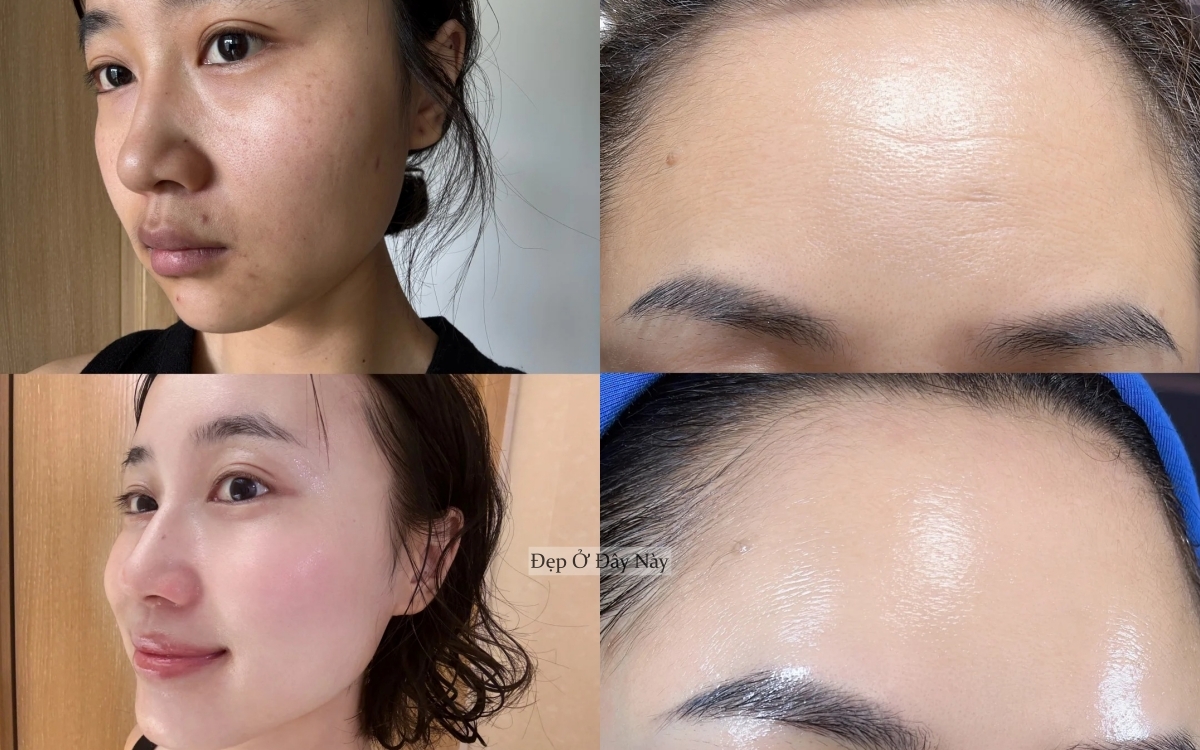 Tôi không skincare cầu kỳ, chỉ ngủ sớm và dưỡng dầu là làn da đã lột xác ngoạn mục!- Ảnh 4. Tôi không skincare cầu kỳ, chỉ ngủ sớm và dưỡng dầu là làn da đã lột xác ngoạn mục!- Ảnh 4.