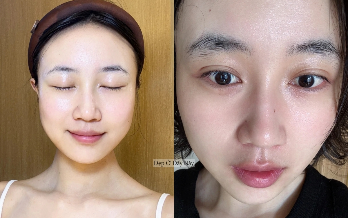 Tôi không skincare cầu kỳ, chỉ ngủ sớm và dưỡng dầu là làn da đã lột xác ngoạn mục!- Ảnh 2. Tôi không skincare cầu kỳ, chỉ ngủ sớm và dưỡng dầu là làn da đã lột xác ngoạn mục!- Ảnh 2.