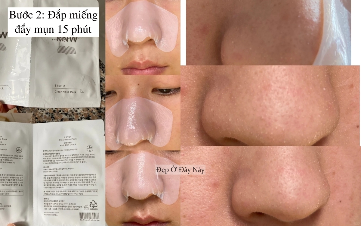 Ở tuổi 27, tôi học được cách làm sạch mụn đầu đen ở mũi hiệu quả, làm 1 lần là "nhẵn thín"- Ảnh 3. Ở tuổi 27, tôi học được cách làm sạch mụn đầu đen ở mũi hiệu quả, làm 1 lần là "nhẵn thín"- Ảnh 3.