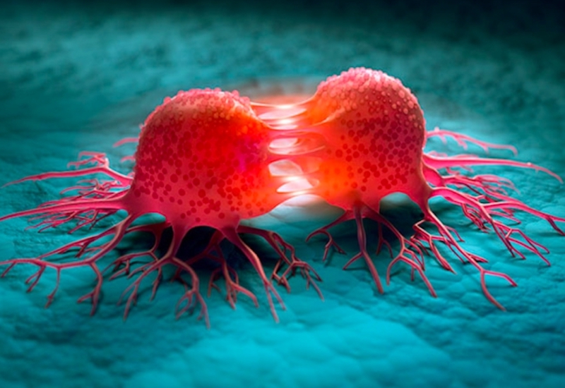 Bác sĩ Mỹ chia sẻ 5 món ăn nhẹ làm tăng khả năng chống ung thư ruột kết gấp bội, ban đầu thấy lạ nhưng “càng ăn càng mê”- Ảnh 1. Bác sĩ Mỹ chia sẻ 5 món ăn nhẹ làm tăng khả năng chống ung thư ruột kết gấp bội, ban đầu thấy lạ nhưng “càng ăn càng mê”- Ảnh 1.