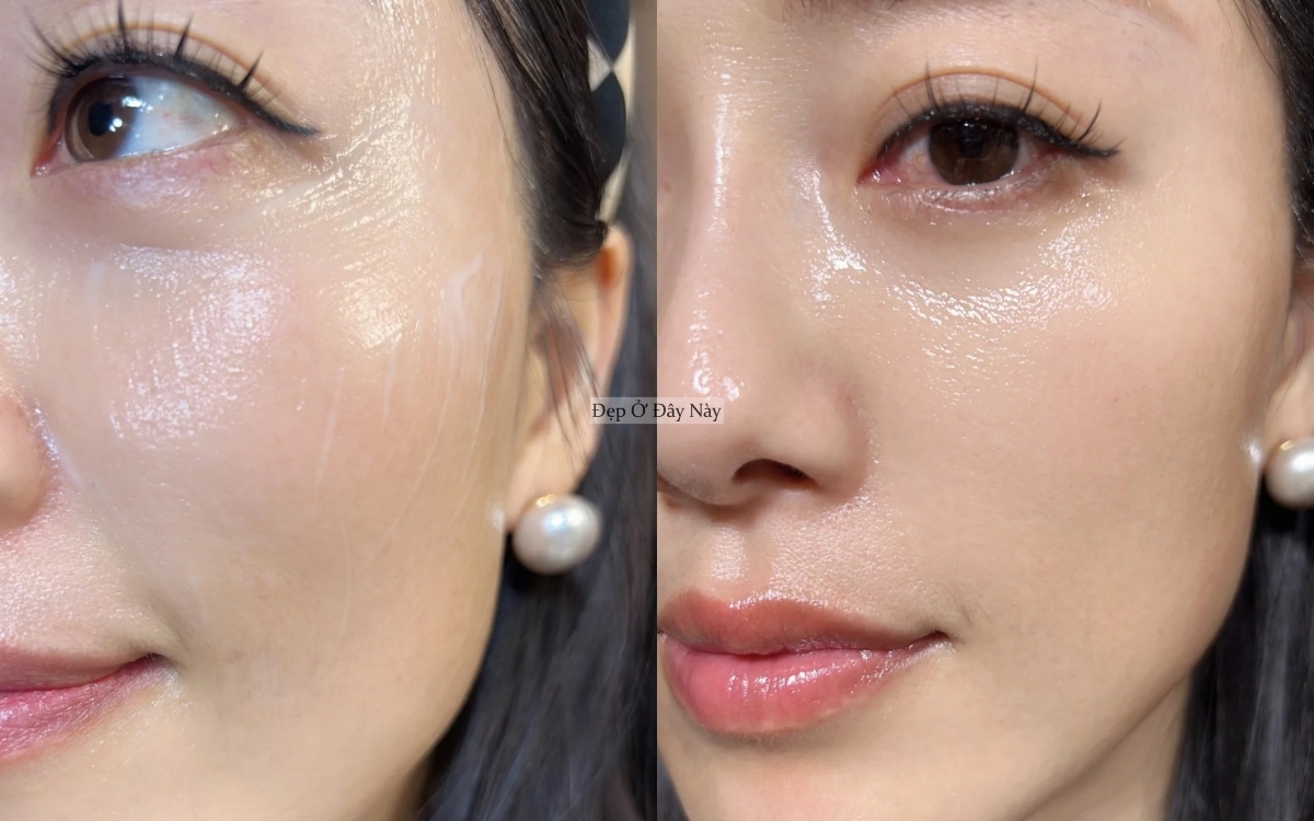 C&aacute;ch dưỡng da "trứng l&ograve;ng đ&agrave;o" gi&uacute;p c&ocirc; n&agrave;ng 32 tuổi c&oacute; l&agrave;n da như mới ngo&agrave;i 20- Ảnh 4.