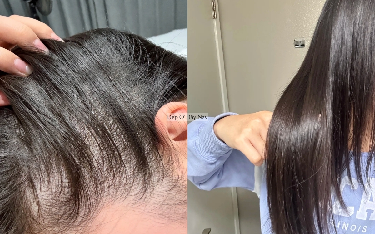 Học từ mẹ, t&ocirc;i đ&atilde; biết c&aacute;ch gội đầu sao cho t&oacute;c mọc tua tủa m&agrave; vẫn tiết kiệm tiền- Ảnh 5.