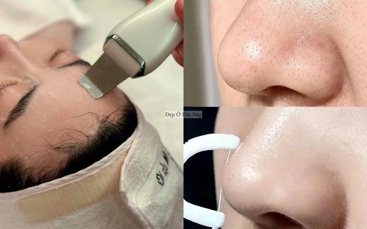 Dưỡng ngoài thôi là chưa đủ, phụ nữ Hàn dùng 4 loại máy này để da đẹp tận lỗ chân lông- Ảnh 5. Dưỡng ngoài thôi là chưa đủ, phụ nữ Hàn dùng 4 loại máy này để da đẹp tận lỗ chân lông- Ảnh 5.