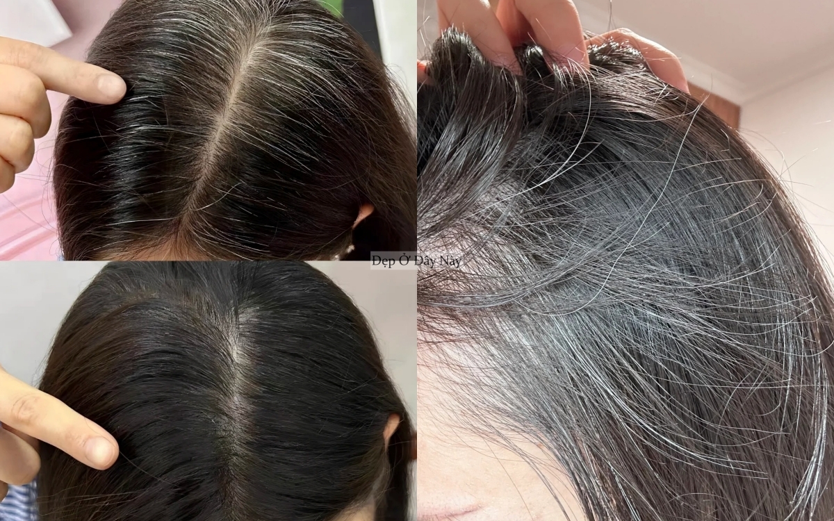 V&igrave; sao phụ nữ trung ni&ecirc;n kh&ocirc;ng n&ecirc;n nhổ t&oacute;c bạc?- Ảnh 3.