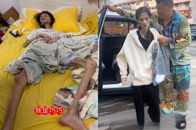 Nữ Tiktoker 27 tuổi qua đời v&igrave; chứng teo dạ d&agrave;y, l&uacute;c cuối đời chỉ c&ograve;n 17,5 kg: Mọi chuyện bắt đầu từ ho&agrave;n cảnh gia đ&igrave;nh- Ảnh 2.