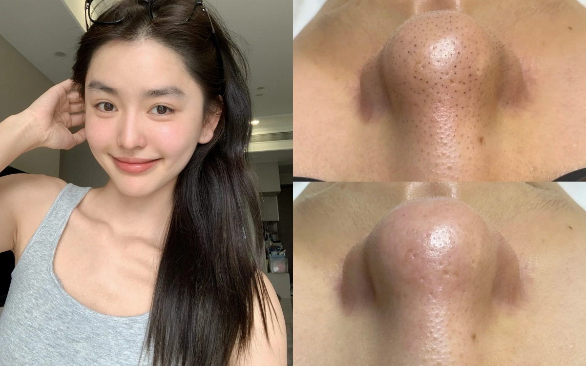 Loại mặt nạ giúp làm sạch sâu lỗ chân lông, nhưng khuyến cáo chỉ nên dùng 1 lần/tuần- Ảnh 1. Loại mặt nạ giúp làm sạch sâu lỗ chân lông, nhưng khuyến cáo chỉ nên dùng 1 lần/tuần- Ảnh 1.