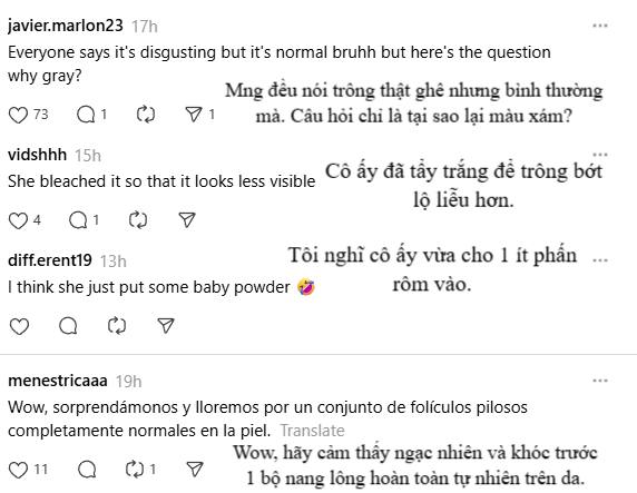 Nữ ca sĩ khoe lông nách trắng xoá, dân tình tranh cãi nảy lửa- Ảnh 4. Nữ ca sĩ khoe lông nách trắng xoá, dân tình tranh cãi nảy lửa- Ảnh 4.