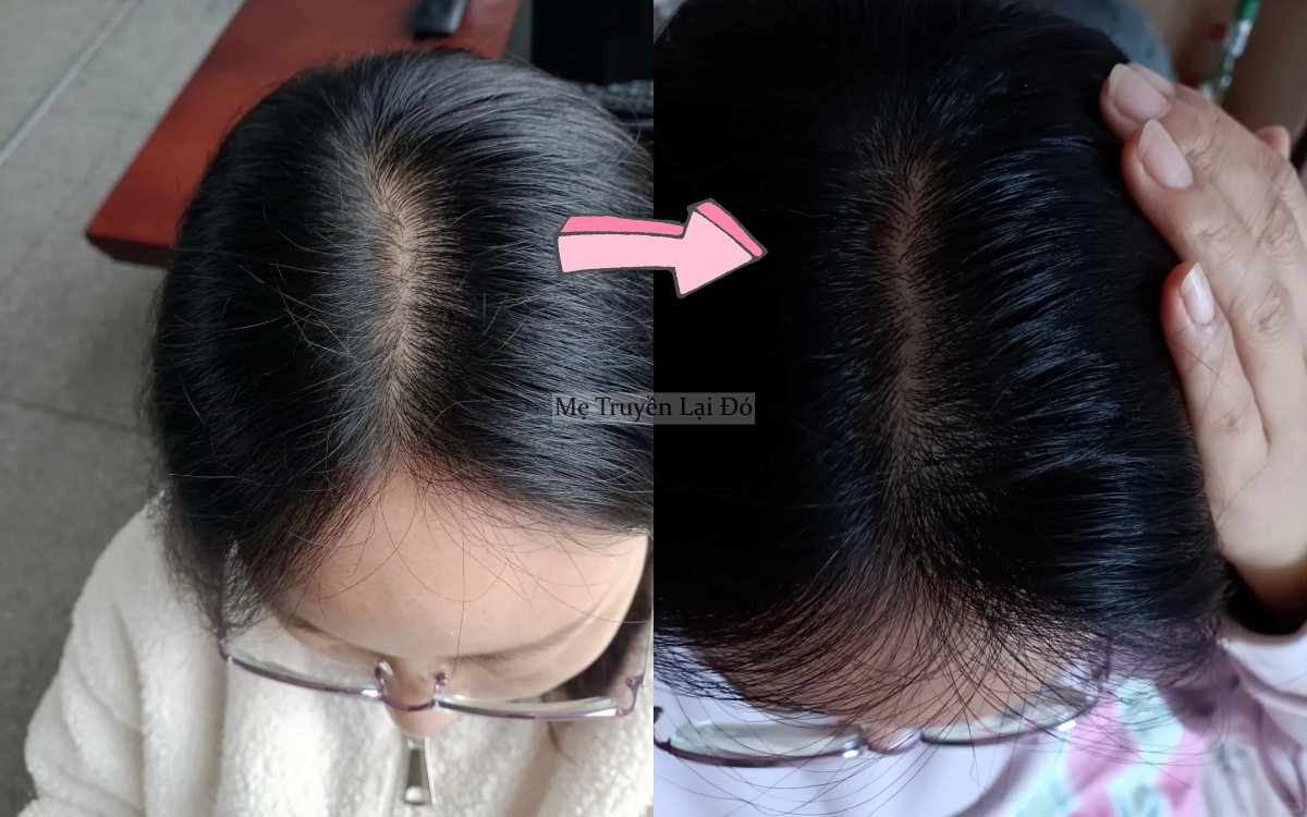 Bao năm mẹ t&ocirc;i d&ugrave;ng vỏ bưởi dưỡng t&oacute;c, t&ocirc;i đ&atilde; t&igrave;m được c&aacute;ch nhanh gọn v&agrave; tiện lợi hơn rất nhiều- Ảnh 3.