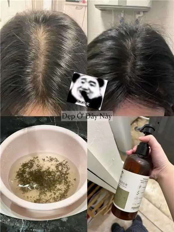 Thứ nước bình dân nhưng lại là "bảo bối" giúp tóc mọc chắc khỏe, được các bà các mẹ truyền tai nhiều đời- Ảnh 3. Thứ nước bình dân nhưng lại là "bảo bối" giúp tóc mọc chắc khỏe, được các bà các mẹ truyền tai nhiều đời- Ảnh 3.