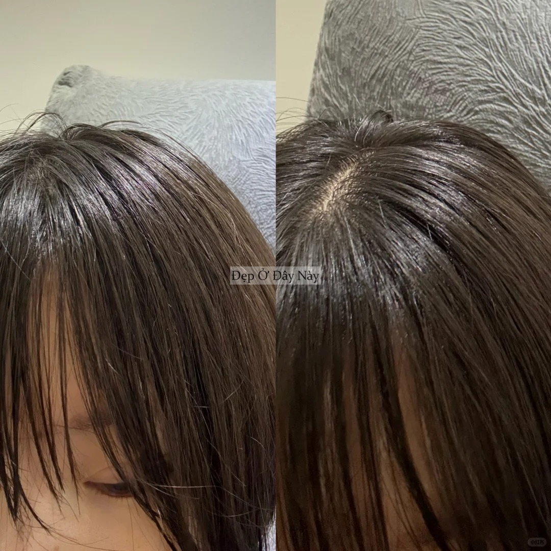 Thứ nước bình dân nhưng lại là "bảo bối" giúp tóc mọc chắc khỏe, được các bà các mẹ truyền tai nhiều đời- Ảnh 5. Thứ nước bình dân nhưng lại là "bảo bối" giúp tóc mọc chắc khỏe, được các bà các mẹ truyền tai nhiều đời- Ảnh 5.