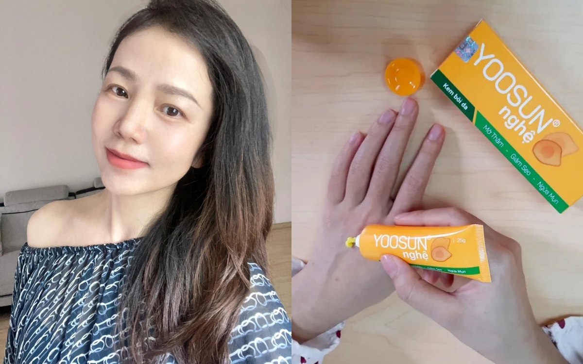 5 sản phẩm chiết xuất nghệ "made in Vietnam" giá rẻ bèo và chất lượng cực mê- Ảnh 1. 5 sản phẩm chiết xuất nghệ "made in Vietnam" giá rẻ bèo và chất lượng cực mê- Ảnh 1.