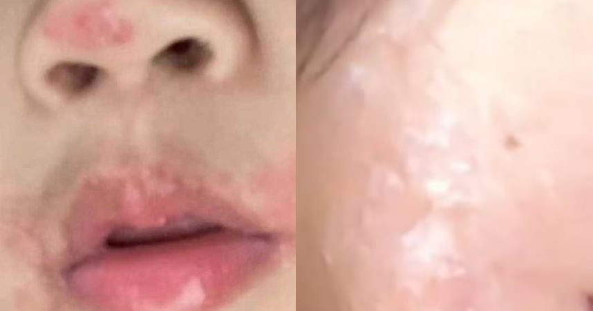 Đi hát karaoke, người phụ nữ nhiễm loại virus không thuốc nào chữa khỏi- Ảnh 1. Đi hát karaoke, người phụ nữ nhiễm loại virus không thuốc nào chữa khỏi- Ảnh 1.