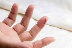 Không thể đông máu, không thể truyền thuốc, không thể giải thích: Ca bệnh khiến bác sĩ cũng "khó chịu vô cùng", 3 năm sau nguyên nhân được hé lộ- Ảnh 4. Không thể đông máu, không thể truyền thuốc, không thể giải thích: Ca bệnh khiến bác sĩ cũng "khó chịu vô cùng", 3 năm sau nguyên nhân được hé lộ- Ảnh 4.