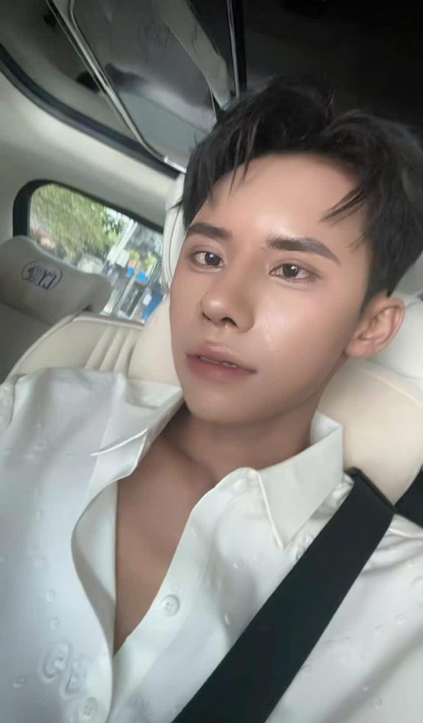 Sốc: Thí sinh Nam vương Campuchia từng bị chế giễu ngoại hình bất ngờ "lột xác" thành trai đẹp sau khi phẫu thuật thẩm mỹ ở Việt Nam- Ảnh 3. Sốc: Thí sinh Nam vương Campuchia từng bị chế giễu ngoại hình bất ngờ "lột xác" thành trai đẹp sau khi phẫu thuật thẩm mỹ ở Việt Nam- Ảnh 3.