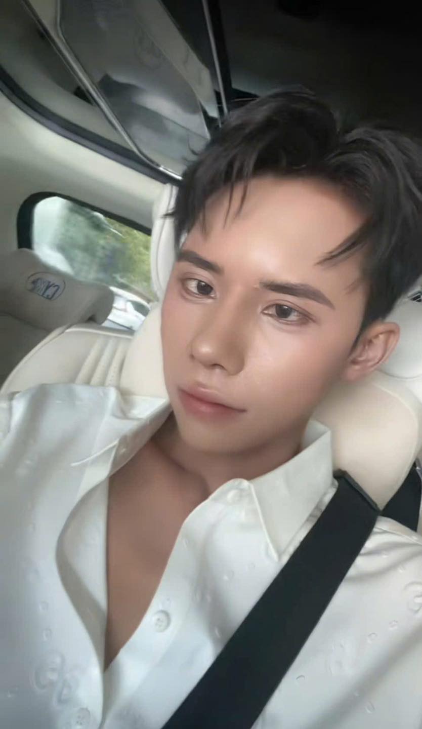 Sốc: Thí sinh Nam vương Campuchia từng bị chế giễu ngoại hình bất ngờ "lột xác" thành trai đẹp sau khi phẫu thuật thẩm mỹ ở Việt Nam- Ảnh 2. Sốc: Thí sinh Nam vương Campuchia từng bị chế giễu ngoại hình bất ngờ "lột xác" thành trai đẹp sau khi phẫu thuật thẩm mỹ ở Việt Nam- Ảnh 2.