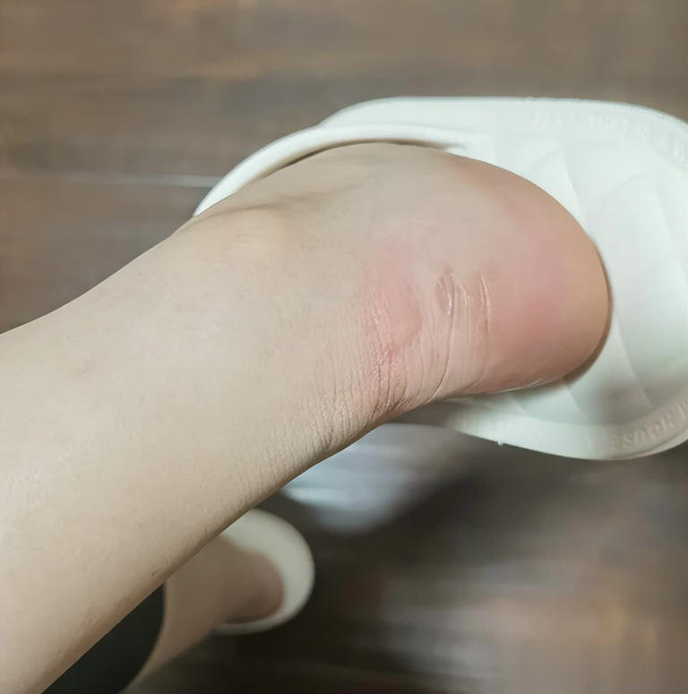 Giá rẻ "sập sàn" cũng đừng mua 4 loại tất này, "tất độc" đeo vào cực hại sức khỏe- Ảnh 4. Giá rẻ "sập sàn" cũng đừng mua 4 loại tất này, "tất độc" đeo vào cực hại sức khỏe- Ảnh 4.