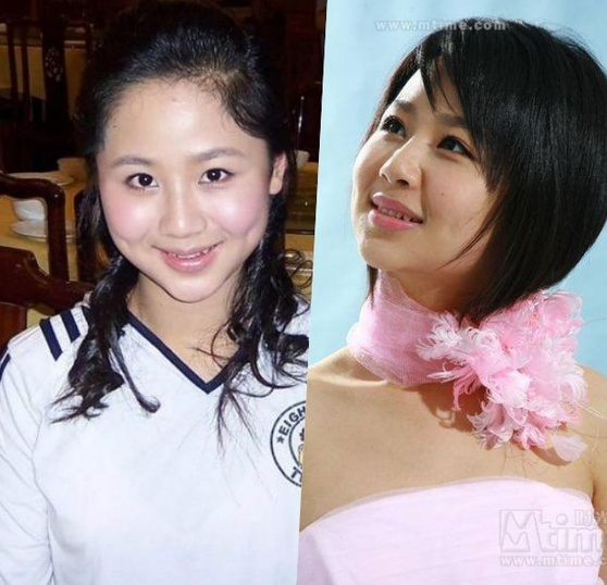 Dương Tử thẩm mỹ để cải thiện nhan sắc nhưng có một bộ phận trên khuôn mặt nữ diễn viên luôn giữ cho đầy đặn, bảo sao đường công danh lẫn tài lộc đều vượng phát- Ảnh 3. Dương Tử thẩm mỹ để cải thiện nhan sắc nhưng có một bộ phận trên khuôn mặt nữ diễn viên luôn giữ cho đầy đặn, bảo sao đường công danh lẫn tài lộc đều vượng phát- Ảnh 3.