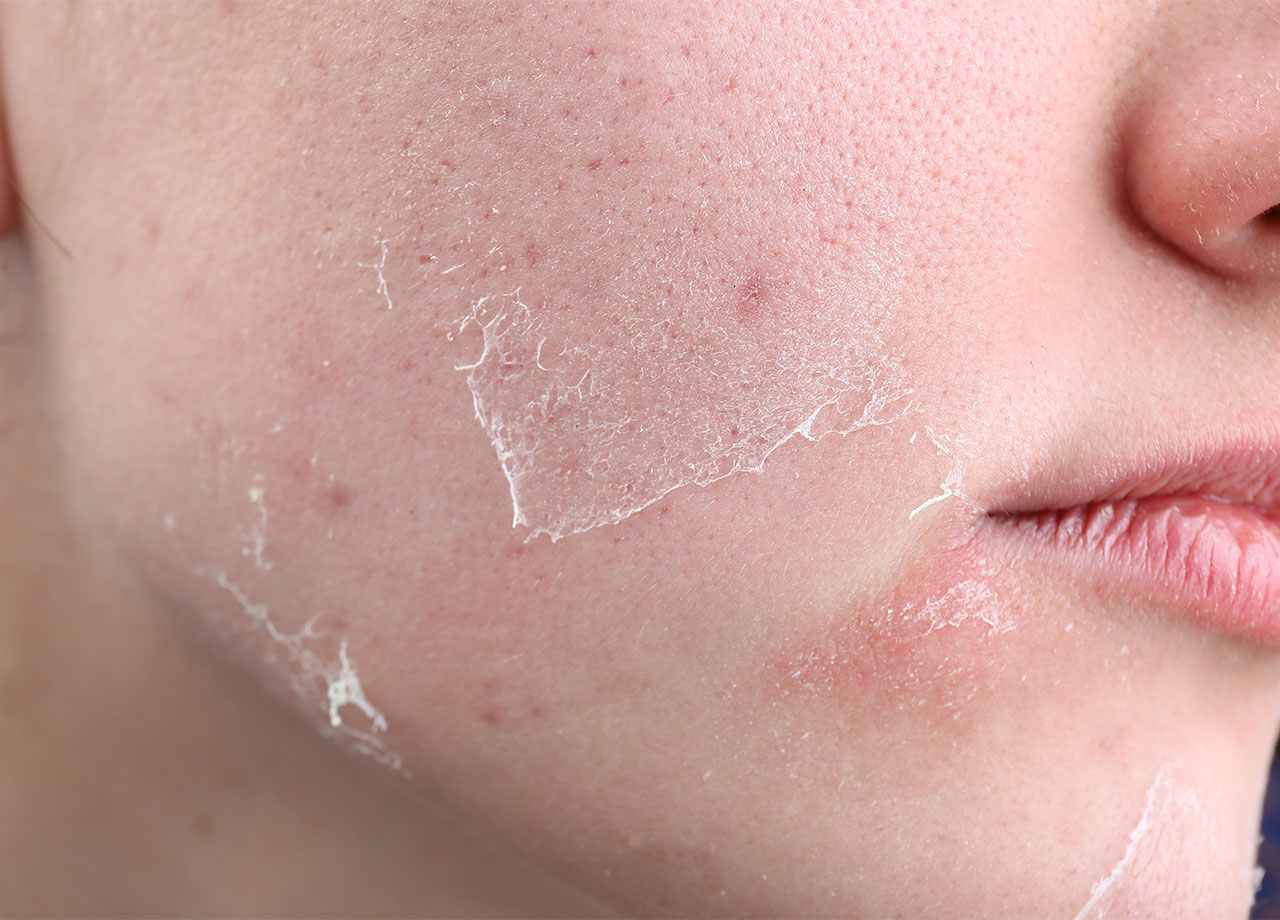 Sau tuổi 40 phụ nữ muốn giữ nhiều collagen trên mặt nhớ tránh 3 thói quen "độc hại", nếu không sẽ lão hóa nhanh, nếp nhăn nhiều- Ảnh 2. Sau tuổi 40 phụ nữ muốn giữ nhiều collagen trên mặt nhớ tránh 3 thói quen "độc hại", nếu không sẽ lão hóa nhanh, nếp nhăn nhiều- Ảnh 2.