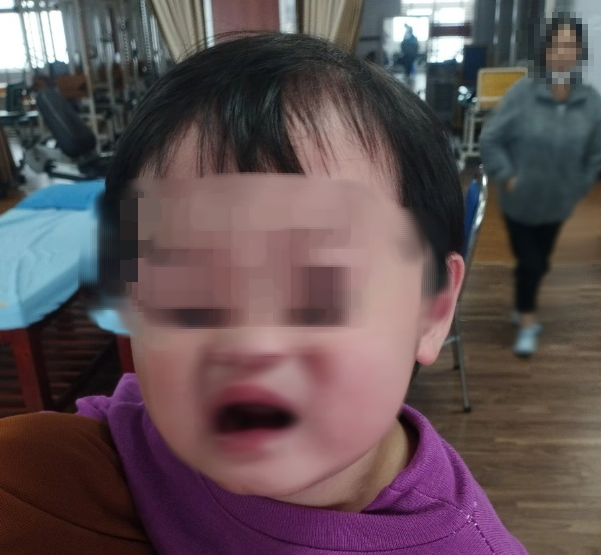 Bé 5 tuổi bị liệt nửa mặt đột ngột: Cảnh báo cha mẹ về căn bệnh trẻ có thể gặp do nằm quạt, điều hòa trong mùa hè- Ảnh 2. Bé 5 tuổi bị liệt nửa mặt đột ngột: Cảnh báo cha mẹ về căn bệnh trẻ có thể gặp do nằm quạt, điều hòa trong mùa hè- Ảnh 2.