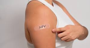 Tại sao một số người tự khỏi HPV trong khi số khác lại phát bệnh? Hiệu quả của các loại vắc xin ngừa HPV như thế nào ở các độ tuổi?- Ảnh 1. Tại sao một số người tự khỏi HPV trong khi số khác lại phát bệnh? Hiệu quả của các loại vắc xin ngừa HPV như thế nào ở các độ tuổi?- Ảnh 1.