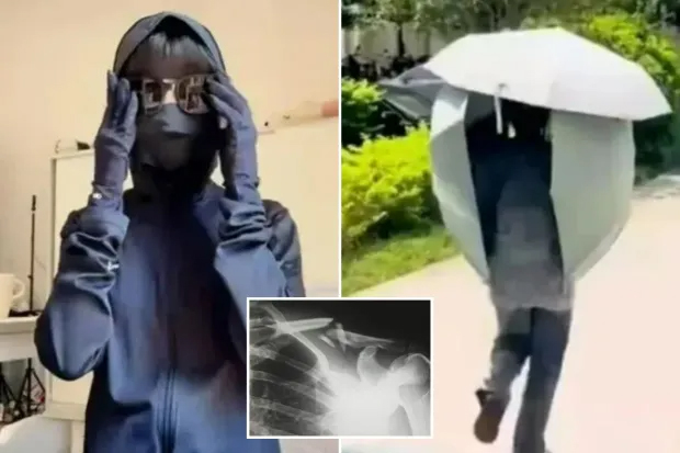1 phụ nữ bị g&atilde;y xương chỉ sau c&uacute; lăn người tr&ecirc;n giường, b&aacute;c sĩ n&oacute;i chống nắng kiểu n&agrave;y m&agrave; kh&ocirc;ng d&ugrave;ng 2 m&oacute;n bổ xương th&igrave; kh&oacute; tr&aacute;nh!- Ảnh 1.