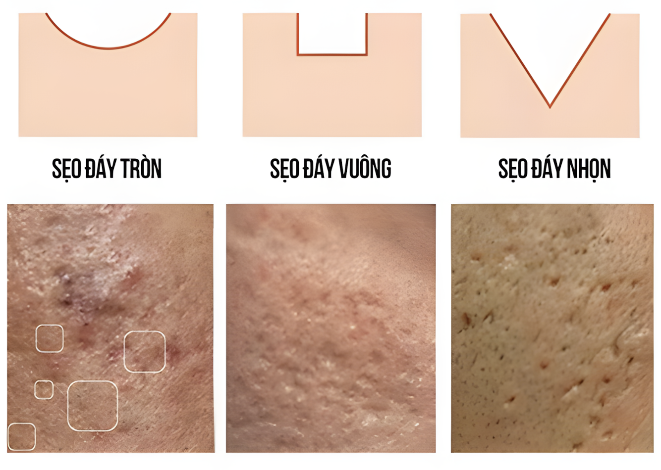 Em Mây Skin Center - Phòng khám tiên phong điều trị sẹo đa phương pháp- Ảnh 2. Em Mây Skin Center - Phòng khám tiên phong điều trị sẹo đa phương pháp- Ảnh 2.