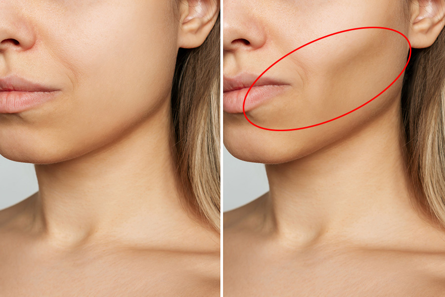 Khuôn mặt lệch, nếp nhăn sớm có thể bắt nguồn từ việc mất răng – Đừng xem nhẹ!- Ảnh 1. Khuôn mặt lệch, nếp nhăn sớm có thể bắt nguồn từ việc mất răng – Đừng xem nhẹ!- Ảnh 1.